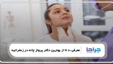 بهترین دکتر پروتز چانه در زعفرانیه