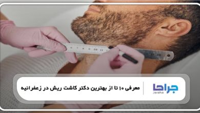 بهترین دکتر کاشت ریش در زعفرانیه