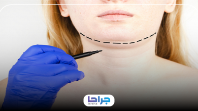 بهترین دکتر ساکشن غبغب در یافت آباد