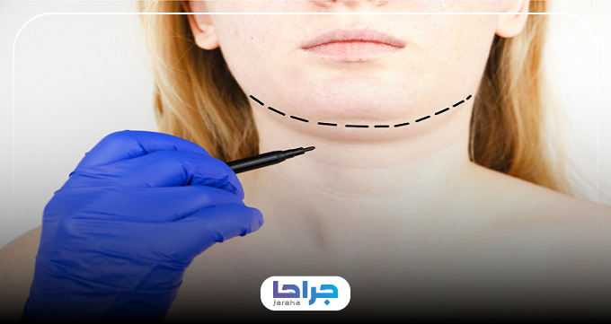 بهترین دکتر ساکشن غبغب در یافت آباد