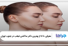 بهترین دکتر ساکشن غبغب در جنوب تهران