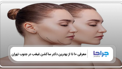 بهترین دکتر ساکشن غبغب در جنوب تهران