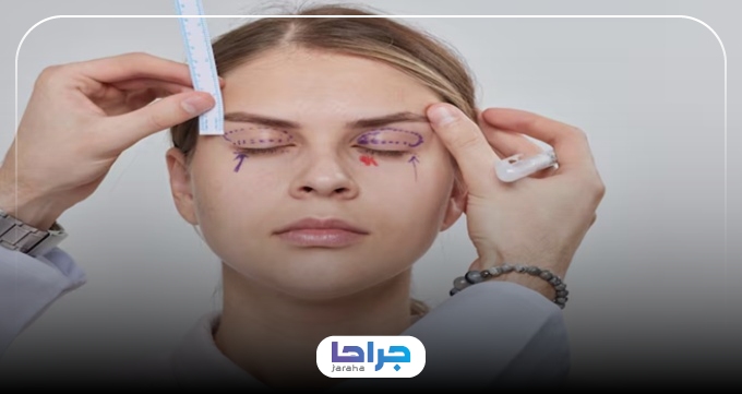 معیارهای انتخاب بهترین جراح افتادگی پلک در زعفرانیه