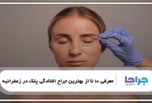 بهترین جراح افتادگی پلک در زعفرانیه