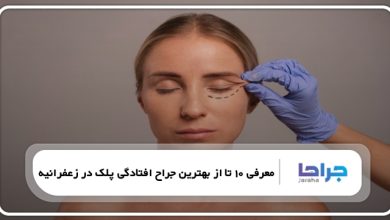 بهترین جراح افتادگی پلک در زعفرانیه