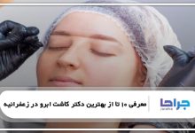 بهترین دکتر کاشت ابرو در زعفرانیه
