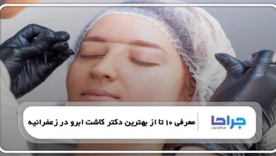 بهترین دکتر کاشت ابرو در زعفرانیه