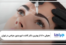 بهترین دکتر کاشت ابرو بدون جراحی در تهران