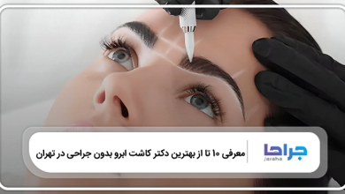 بهترین دکتر کاشت ابرو بدون جراحی در تهران