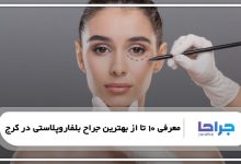 بهترین جراح بلفاروپلاستی در کرج