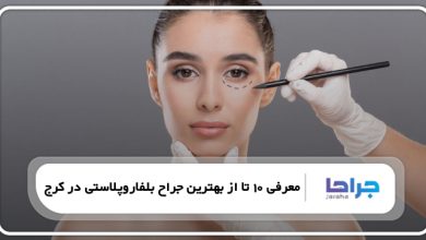 بهترین جراح بلفاروپلاستی در کرج