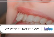 بهترین دکتر لمینت در اهواز