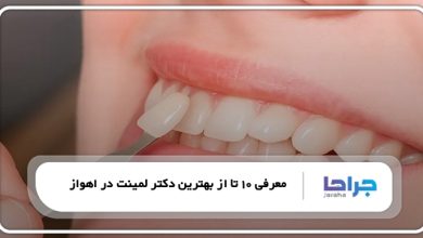 بهترین دکتر لمینت در اهواز