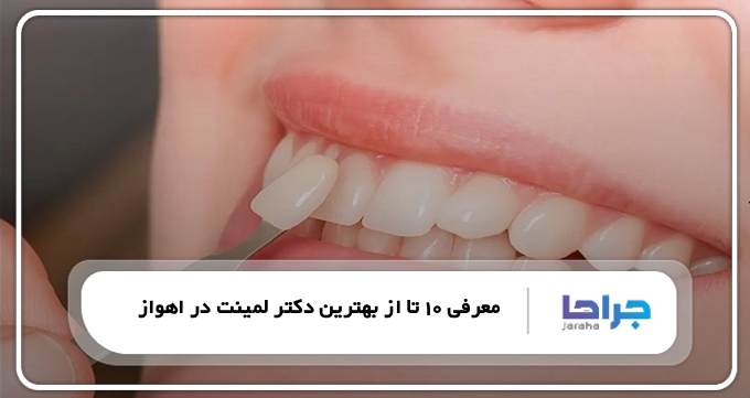 بهترین دکتر لمینت در اهواز