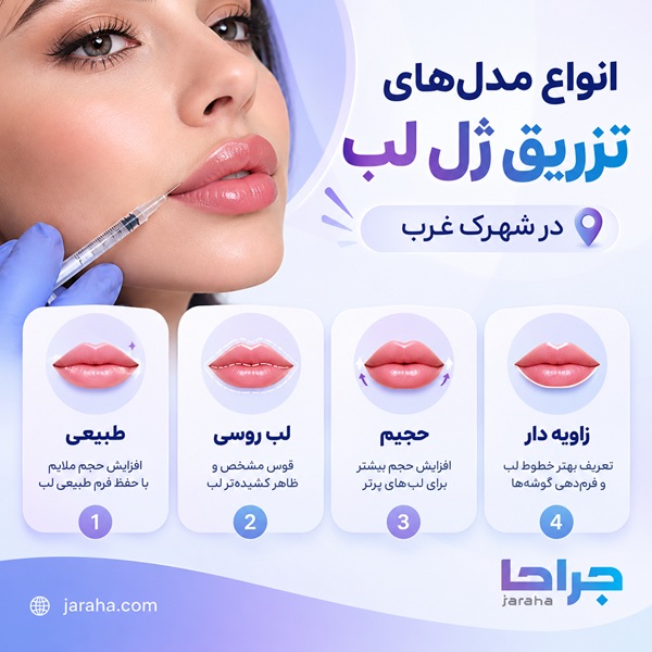 Best doctor for lip filler injections in Shahrak-e Gharb 1