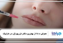 بهترین دکتر تزریق ژل در مارلیک