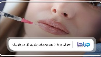 بهترین دکتر تزریق ژل در مارلیک