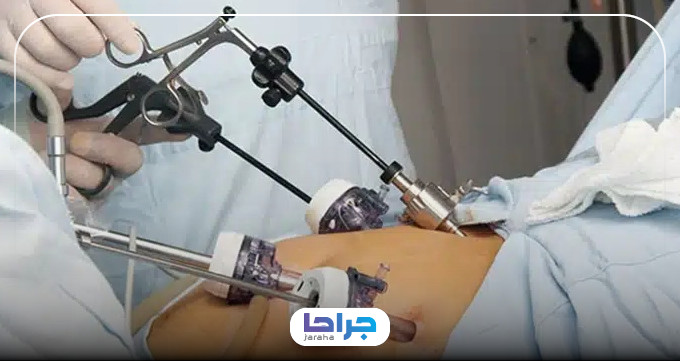 ویژگیهای بهترین دکتر اسلیو معده در کرج