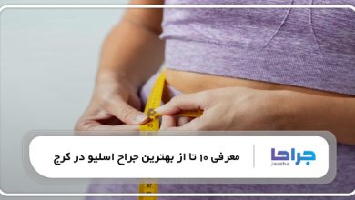 بهترین جراح اسلیو در کرج