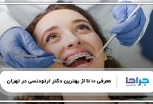 بهترین دکتر ارتودنسی در تهران