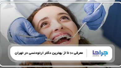 بهترین دکتر ارتودنسی در تهران