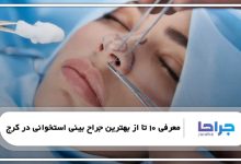 معرفی 10 تا از بهترین جراح بینی استخوانی در کرج
