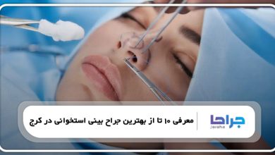 بهترین جراح بینی استخوانی در کرج