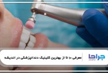 معرفی 10 تا از بهترین کلینیک دندانپزشکی در اندیشه ❤️【سال1405】⭐