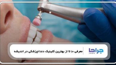 معرفی 10 تا از بهترین کلینیک دندانپزشکی در اندیشه ❤️【سال1405】⭐