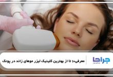 10 تا از بهترین کلینیک لیزر موهای زائد در پونک⭐【سال1405】⚡