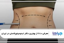 بهترین دکتر ابدومینوپلاستی در ایران