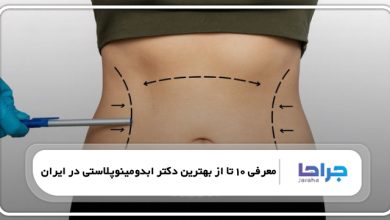 بهترین دکتر ابدومینوپلاستی در ایران