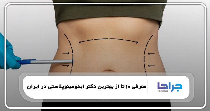 بهترین دکتر ابدومینوپلاستی در ایران