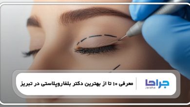 بهترین دکتر بلفاروپلاستی در تبریز