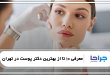 معرفی 10 تا از بهترین دکتر پوست در تهران