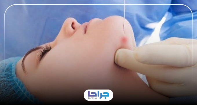 فاکتورهای کلیدی برای انتخاب بهترین مرکز اندولیفت در تهران