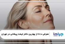 بهترین کاندیدای لیفت پیشانی