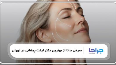 بهترین کاندیدای لیفت پیشانی
