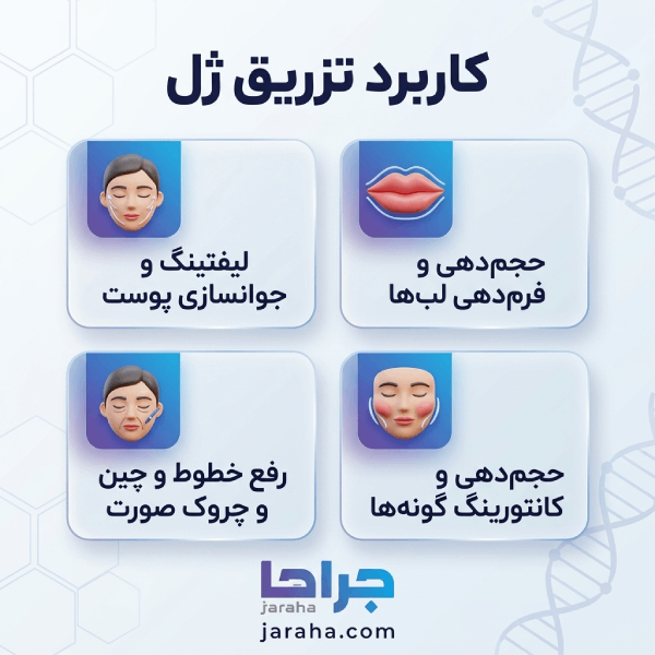 بررسی انواع ژلهای تزریقی و کاربرد هر کدام