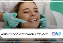 معرفی 10 تا از بهترین متخصص ایمپلنت در تهران