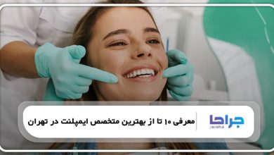 معرفی 10 تا از بهترین متخصص ایمپلنت در تهران