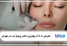 معرفی 10 تا از بهترین دکتر پروتز لب در تهران