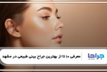 بهترین جراح بینی طبیعی در مشهد