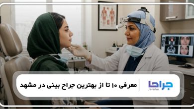 بهترین جراح بینی در مشهد