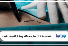 معرفی 10 تا از بهترین دکتر پیکرتراشی در شیراز
