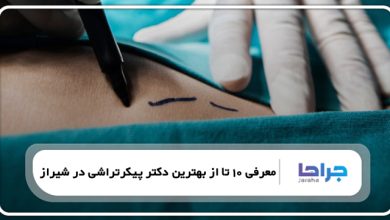 معرفی 10 تا از بهترین دکتر پیکرتراشی در شیراز