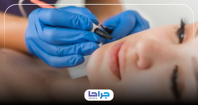 قبل از انتخاب مرکز الکترولیز موهای سفید در تهران این نکات را بدانید