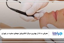 بهترین مرکز الکترولیز موهای سفید در تهران