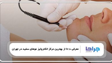بهترین مرکز الکترولیز موهای سفید در تهران