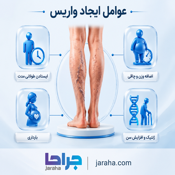 واریس چیست و چگونه رخ می دهد؟